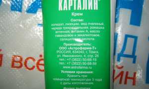 Применение мази «Карталин» при псориазе