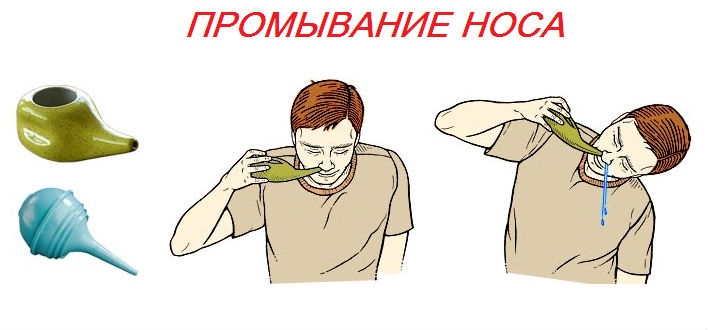 Промывание носа