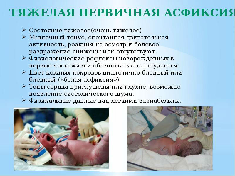 Первичная асфиксия