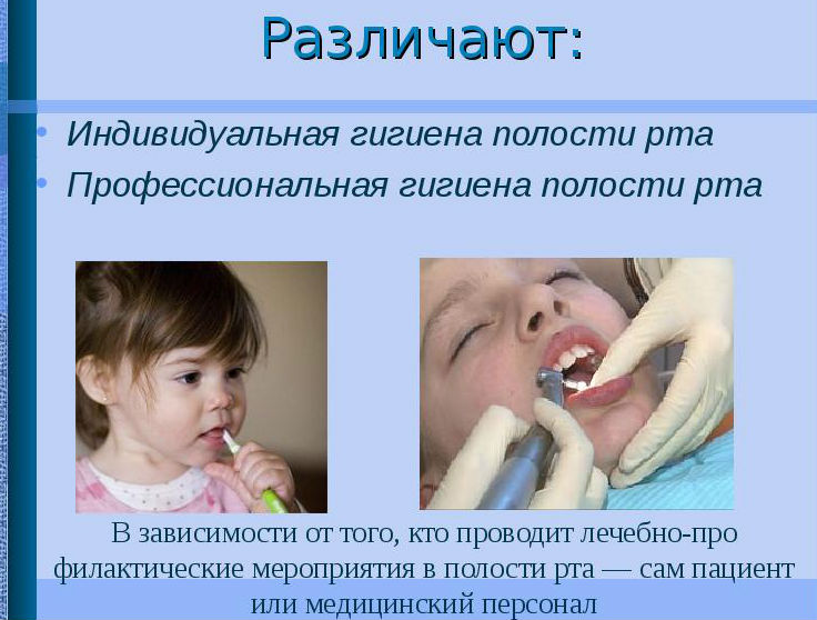 Виды гигиены полости рта