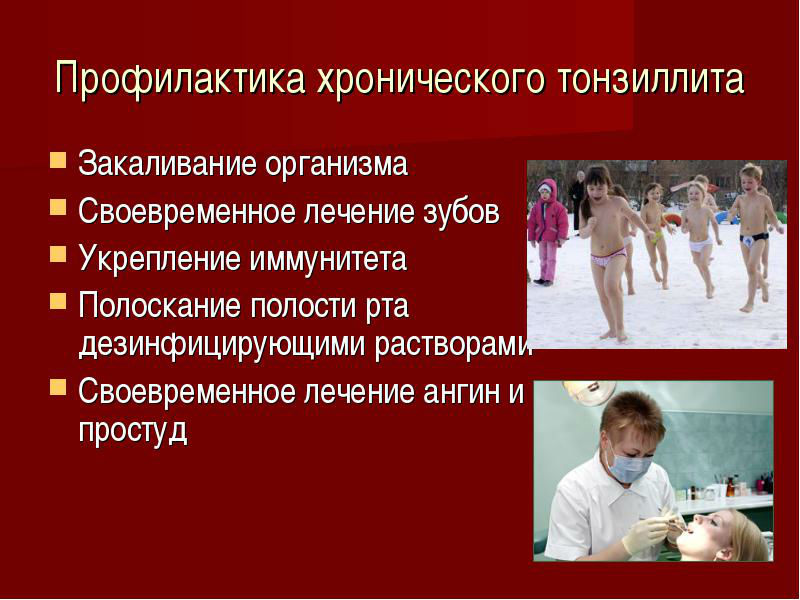 Профилактика тонзиллита