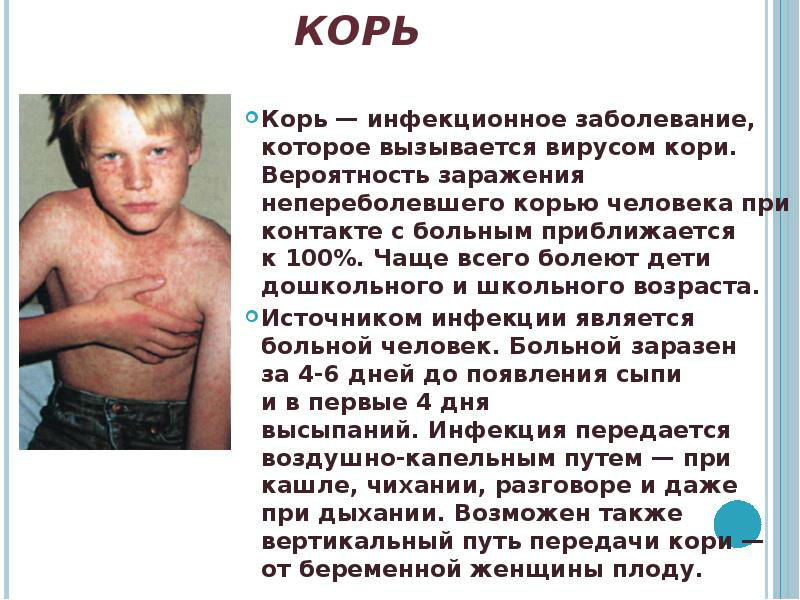 Корь