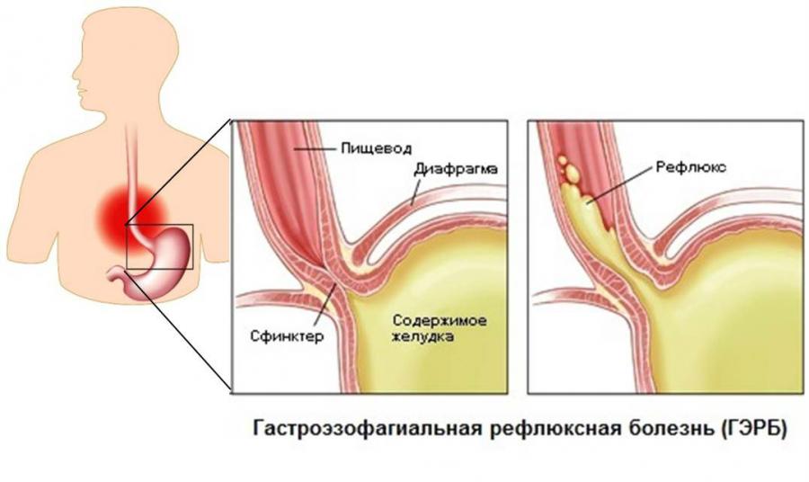 ГЭРБ