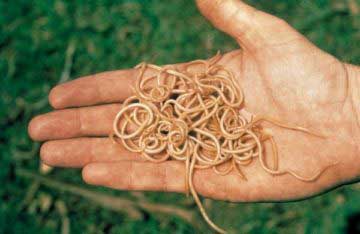 Признаки наличия остриц