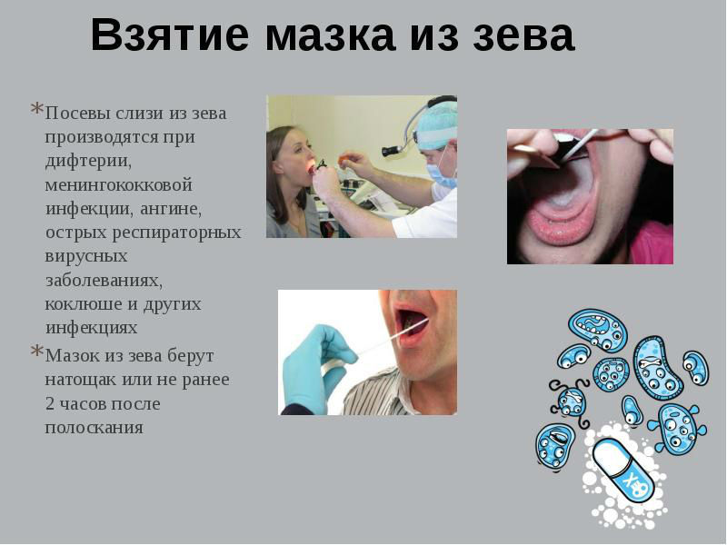 Мазок из зева