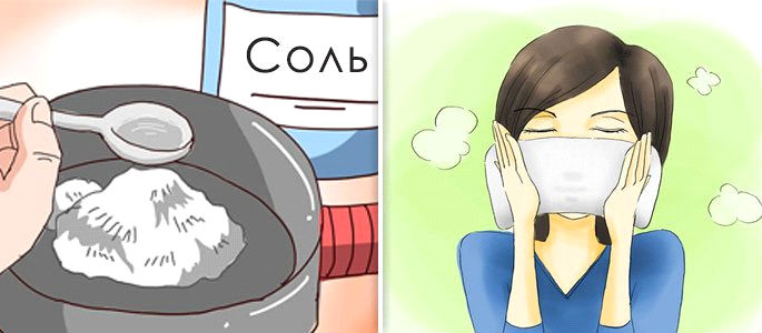 Прогревание солью