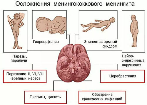 Осложнения менингита