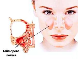 Гайморова пазуха