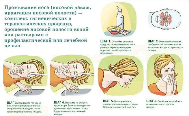 Промывание носа