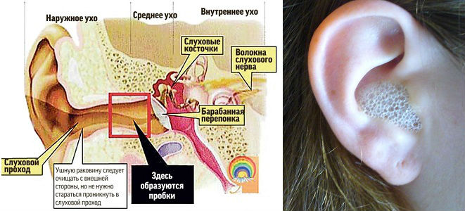 Перекись для чистки ушей Перекись для чистки ушей