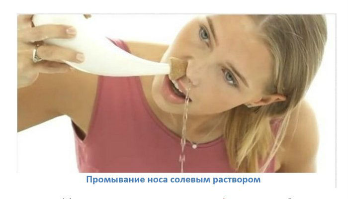 Промывание носа