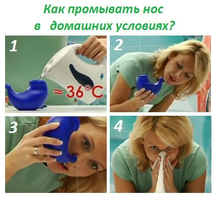 Инструкция по промыванию носа Инструкция по промыванию носа