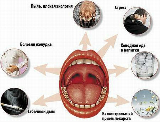 Причины боли в горле Причины боли в горле