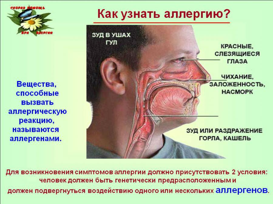 Симптомы и причины аллергии