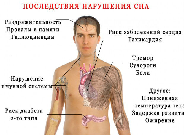 Последствия храпа Последствия храпа