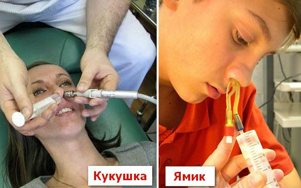 ЯМИК и кукушка
