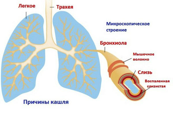 Причины кашля