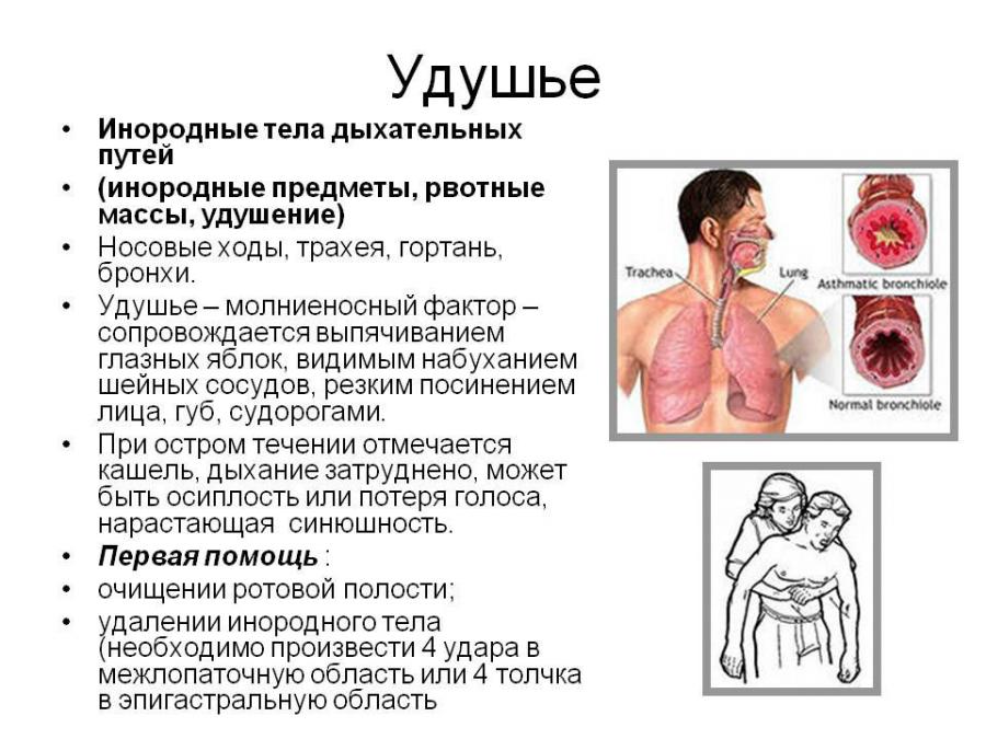 Помощь при удушье