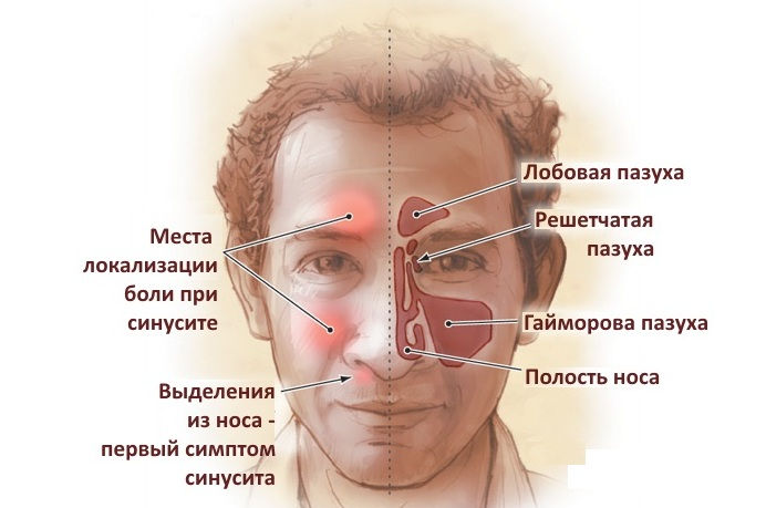 Пазухи носа