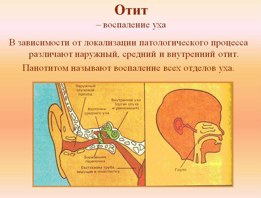 Отит
